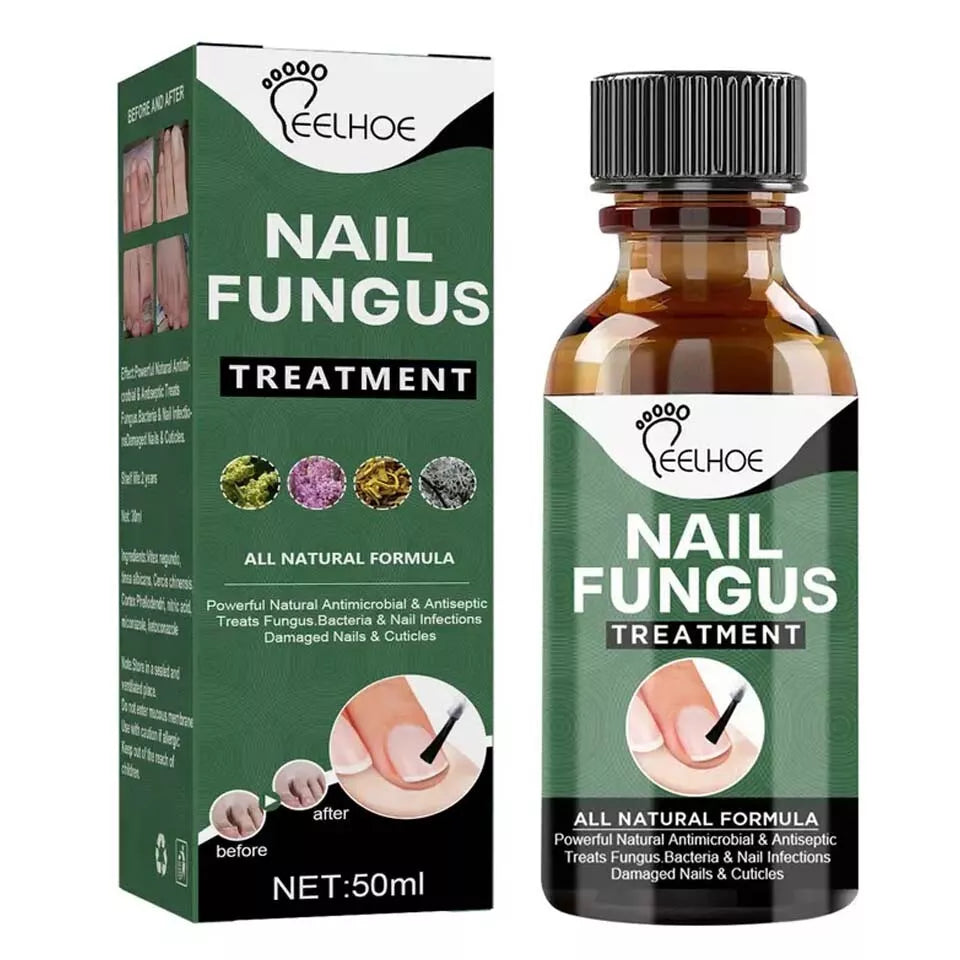 Best Fungal Nail Treatment Liquid | Highly Effective | Kills Toenail Fungus