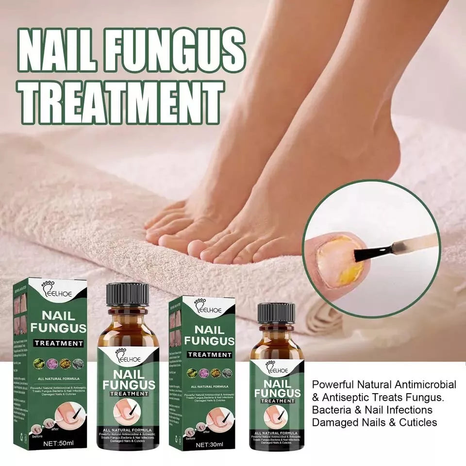 Best Fungal Nail Treatment Liquid | Highly Effective | Kills Toenail Fungus