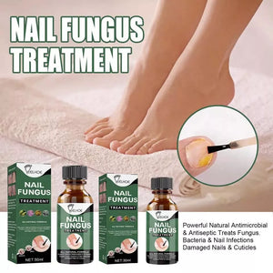 Best Fungal Nail Treatment Liquid | Highly Effective | Kills Toenail Fungus