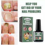 Best Fungal Nail Treatment Liquid | Highly Effective | Kills Toenail Fungus