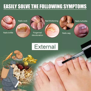 Best Fungal Nail Treatment Liquid | Highly Effective | Kills Toenail Fungus