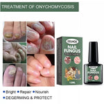 Best Fungal Nail Treatment Liquid | Highly Effective | Kills Toenail Fungus