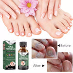 Best Fungal Nail Treatment Liquid | Highly Effective | Kills Toenail Fungus