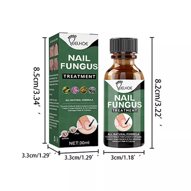 Best Fungal Nail Treatment Liquid | Highly Effective | Kills Toenail Fungus