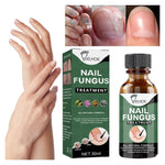 Best Fungal Nail Treatment Liquid | Highly Effective | Kills Toenail Fungus