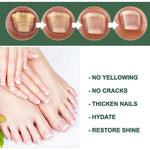 Best Fungal Nail Treatment Liquid | Highly Effective | Kills Toenail Fungus