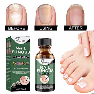 Best Fungal Nail Treatment Liquid | Highly Effective | Kills Toenail Fungus