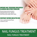 Best Fungal Nail Treatment Liquid | Highly Effective | Kills Toenail Fungus