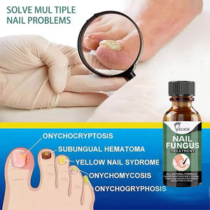 Best Fungal Nail Treatment Liquid | Highly Effective | Kills Toenail Fungus