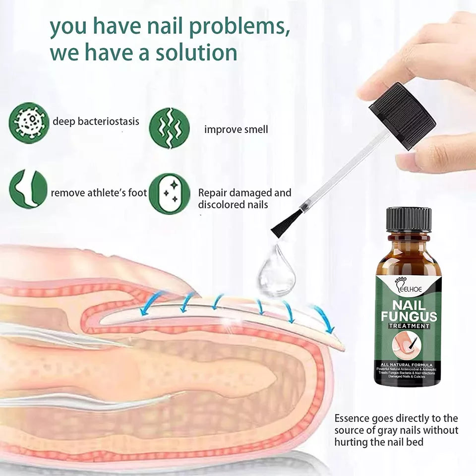 Best Fungal Nail Treatment Liquid | Highly Effective | Kills Toenail Fungus