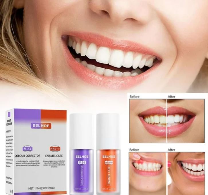 Teeth Whitening Colour Corrector with Enamel Care – Brighten Your Smile Instantly!